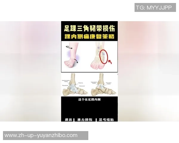 足球运动中的跟腱损伤预防与康复策略探讨